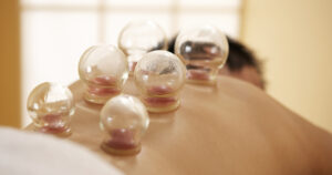 acupuncture vancouver, vancouver acupuncture