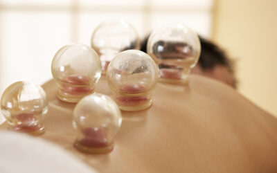 Cupping Therapy for Pain