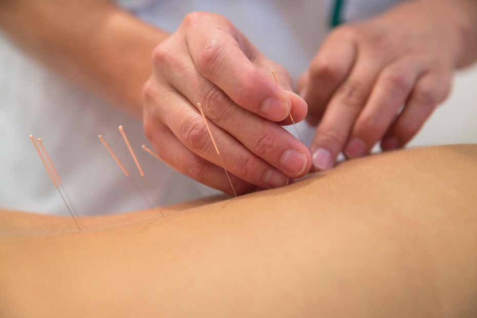 An Acupuncture message from Hannah to You.