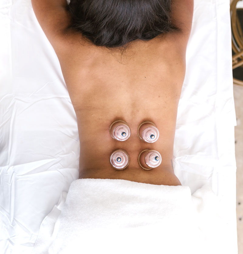 acupuncture vancouver, vancouver acupuncture