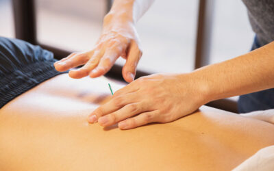 Your Acupuncture Myths Answered