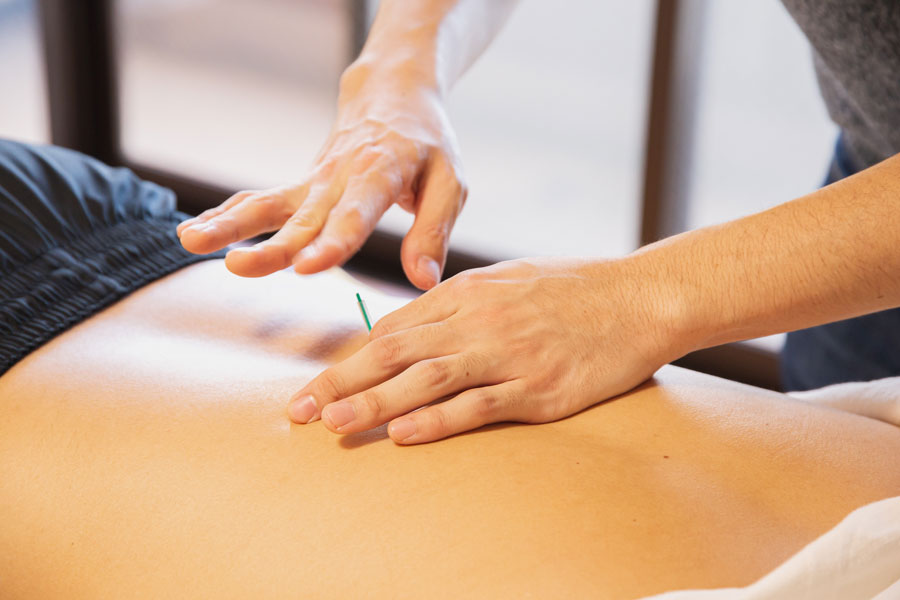 Your Acupuncture Myths Answered