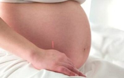 Acupuncture for Birth Preparation